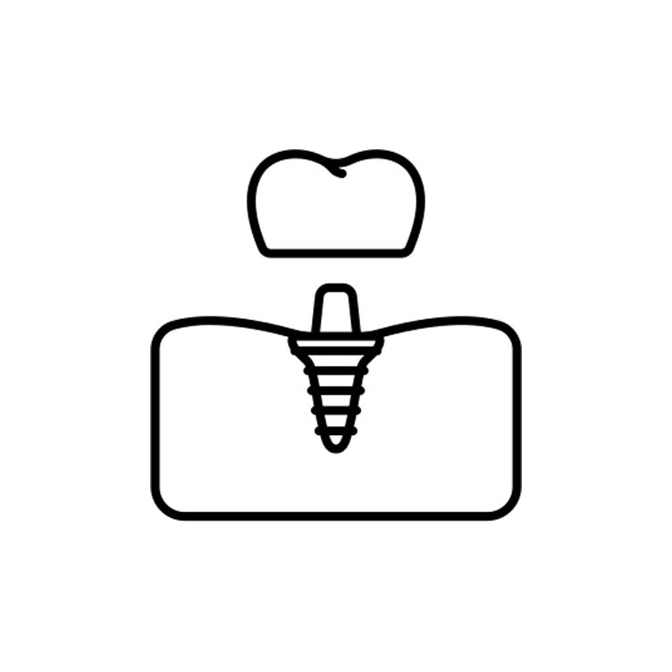 Dentistry Menlo Park CA Implants Icon